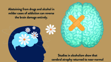 How Long to Rewire Brain from Addiction