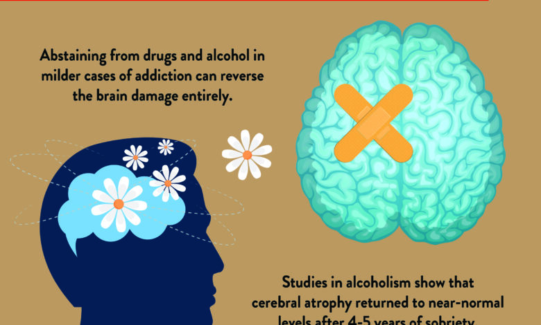 How Long to Rewire Brain from Addiction