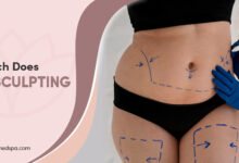 How Much is Coolsculpting