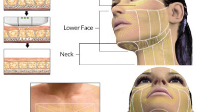 How to Get Rid of Neck Fat
